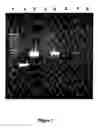 Fig. 02 - Method for isolating hepatocytes