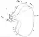 Fig. 02 - Passenger airbag with a diffuser