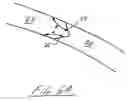 Fig. 08 - Hybrid contact lens system and method