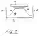 Fig. 04 - Hybrid contact lens system and method