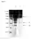 Fig. 07 - Recombinant protein comprising starch binding domain and use thereof