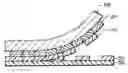 Fig. 01 - Process for thick film circuit patterning