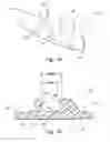 Fig. 02 - Orthodontic retainer system with removable retaining wire