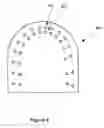 Fig. 09 - Producing physical dental arch model having individually adjustable tooth models