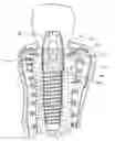 Fig. 01 - Natural implant system