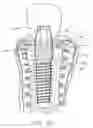 Fig. 09 - Natural implant system