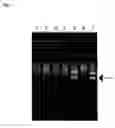 Fig. 02 - Method of typing gene polymorphisms