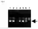 Fig. 10 - Method of typing gene polymorphisms