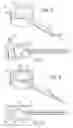 Fig. 04 - Arrangement for management of lead wires
