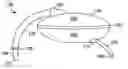 Fig. 01 - Devices and methods for blood flow assistance