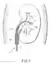 Fig. 07 - Endoscope