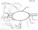 Fig. 05 - Endoscopic sheath having a biomimetic retractor