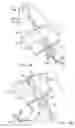 Fig. 03 - Intra-abdominal medical procedures and device
