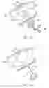 Fig. 06 - Intra-abdominal medical procedures and device