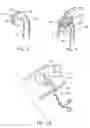 Fig. 07 - Intra-abdominal medical procedures and device