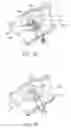 Fig. 09 - Intra-abdominal medical procedures and device