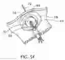 Fig. 10 - Intra-abdominal medical procedures and device