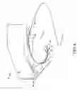 Fig. 05 - Articulated placement guide for sensor-based noninvasive blood pressure monitor