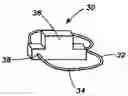 Fig. 01 - Apparatus and method for sensor deployment and fixation