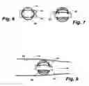 Fig. 03 - Apparatus and method for sensor deployment and fixation
