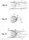 Fig. 05 - Apparatus and method for sensor deployment and fixation