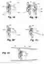 Fig. 06 - Apparatus and method for sensor deployment and fixation