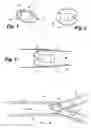 Fig. 02 - Apparatus and method for sensor deployment and fixation
