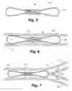 Fig. 03 - Apparatus and method for sensor deployment and fixation
