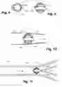 Fig. 04 - Apparatus and method for sensor deployment and fixation