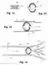 Fig. 05 - Apparatus and method for sensor deployment and fixation