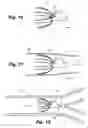 Fig. 06 - Apparatus and method for sensor deployment and fixation