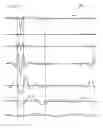 Fig. 15 - Apparatus for signal decomposition, analysis and reconstruction