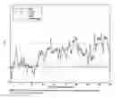 Fig. 08 - Noninvasive nonlinear systems and methods for predicting seizure