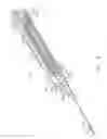 Fig. 04 - Biopsy device with variable side aperture