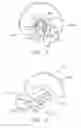 Fig. 07 - Biopsy device with variable side aperture