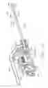 Fig. 24 - Biopsy device with variable side aperture