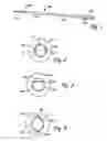 Fig. 02 - Steerable device having a corewire within a tube and combination with a functional medical component
