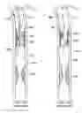 Fig. 08 - Removable sheath for device protection