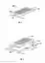 Fig. 02 - Supplemental support structures adapted to receive a non-invasive dynamic motion therapy device