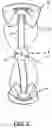 Fig. 03 - Orthotic or prosthetic devices with adjustable force dosimeter and sensor