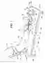 Fig. 02 - Stabilization and traction apparatus and method for non-operative treatment of distal radius and upper extremity fractures