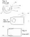 Fig. 03 - Multi-port infusion sleeve