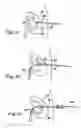Fig. 05 - Drainage catheter