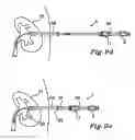 Fig. 12 - Drainage catheter