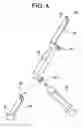 Fig. 05 - System for access into bodily cavity