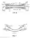Fig. 08 - Tissue transfer cannula and connectors