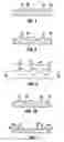 Fig. 05 - SKIN TREATMENT APPARATUS AND METHODS