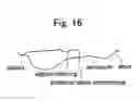 Fig. 09 - Interlabial pad