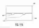 Fig. 11 - Medical infusion device having a refillable reservoir and switch for controlling fluid direction