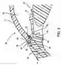 Fig. 03 - Liquid jet for glaucoma treatment